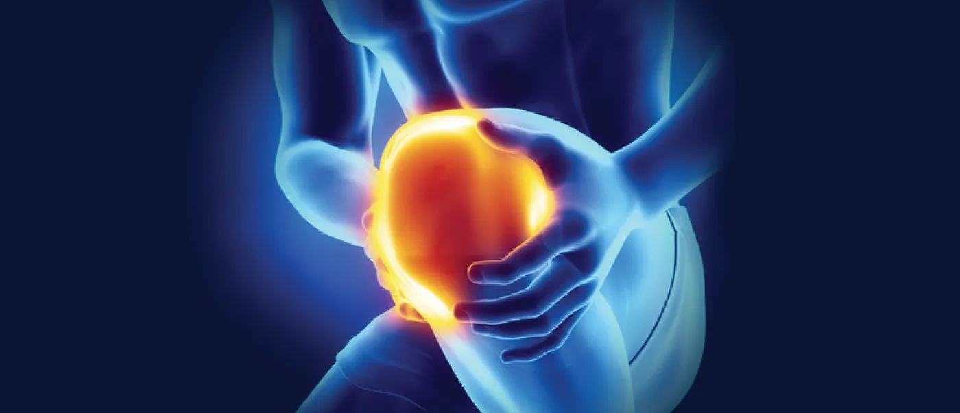 Illustration of an inflamed knee joint